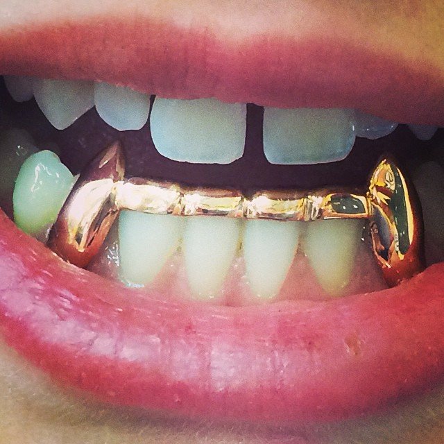 Extended Fangs with Bar to Connect with Protective Layer Added