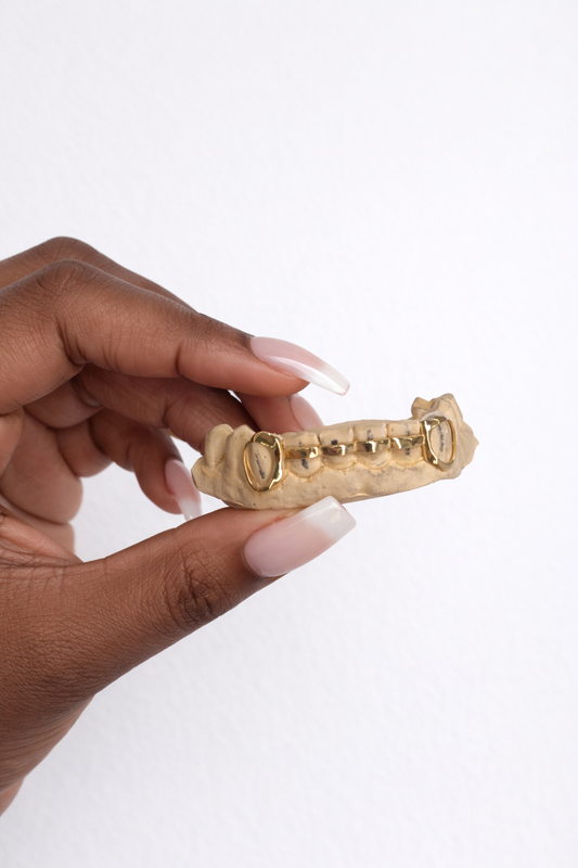 Are Grillz Bad for Your Teeth? (Quick Answer)