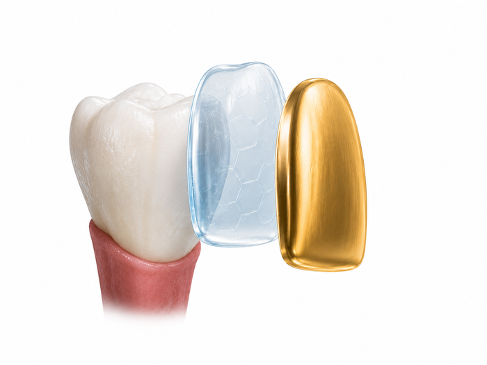 The Protective Mouth Grill in cross-section